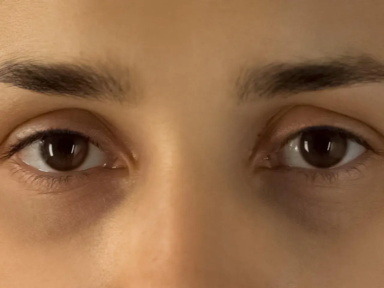 Augenringe mangel an Schlaf. Dunkle Schatten unter den Augen deuten auf Müdigkeit hin.
