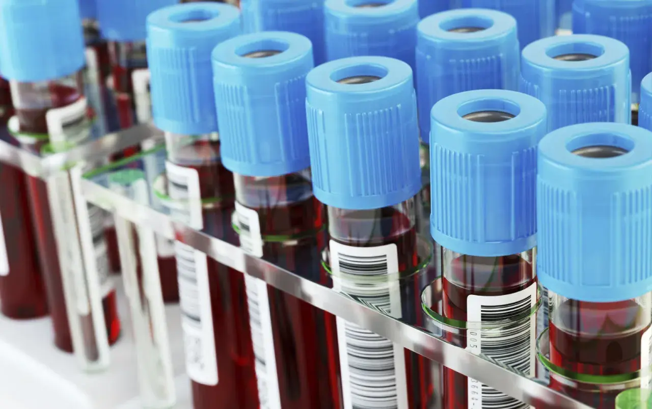 Rząd probówek z krwią, każda z niebieską zakrętką. W tle widać więcej probówek, tworząc laboratoryjny prf.
