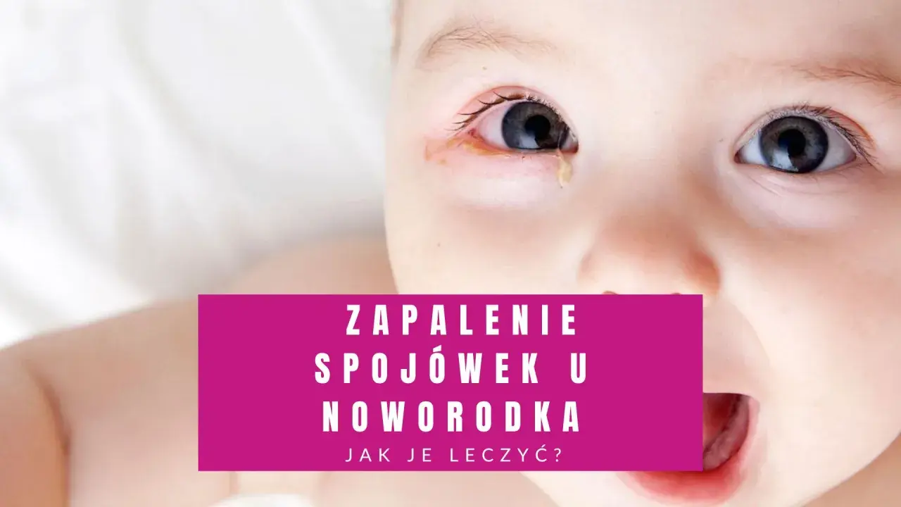 Zbliżenie na twarz noworodka z widocznymi zaczerwienionymi powiekami i łzawieniem. Tekst informuje o zapaleniu spojówek u noworodka.