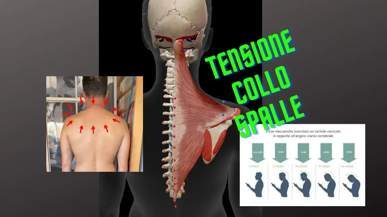 Anatomia muscolare e scheletrica del collo e delle spalle, con frecce rosse che indicano punti di dolore e un grafico sulla tensione muscolare collo.