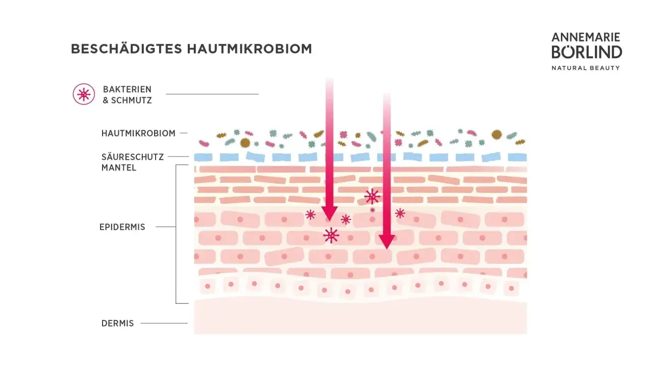 Schädigtes Hautmikrobiom: Bakterien und Schmutz dringen ein. Eine gesunde Hautbarriere ist die Wunderwaffe für ein gesundes Hautmikrobiom.
