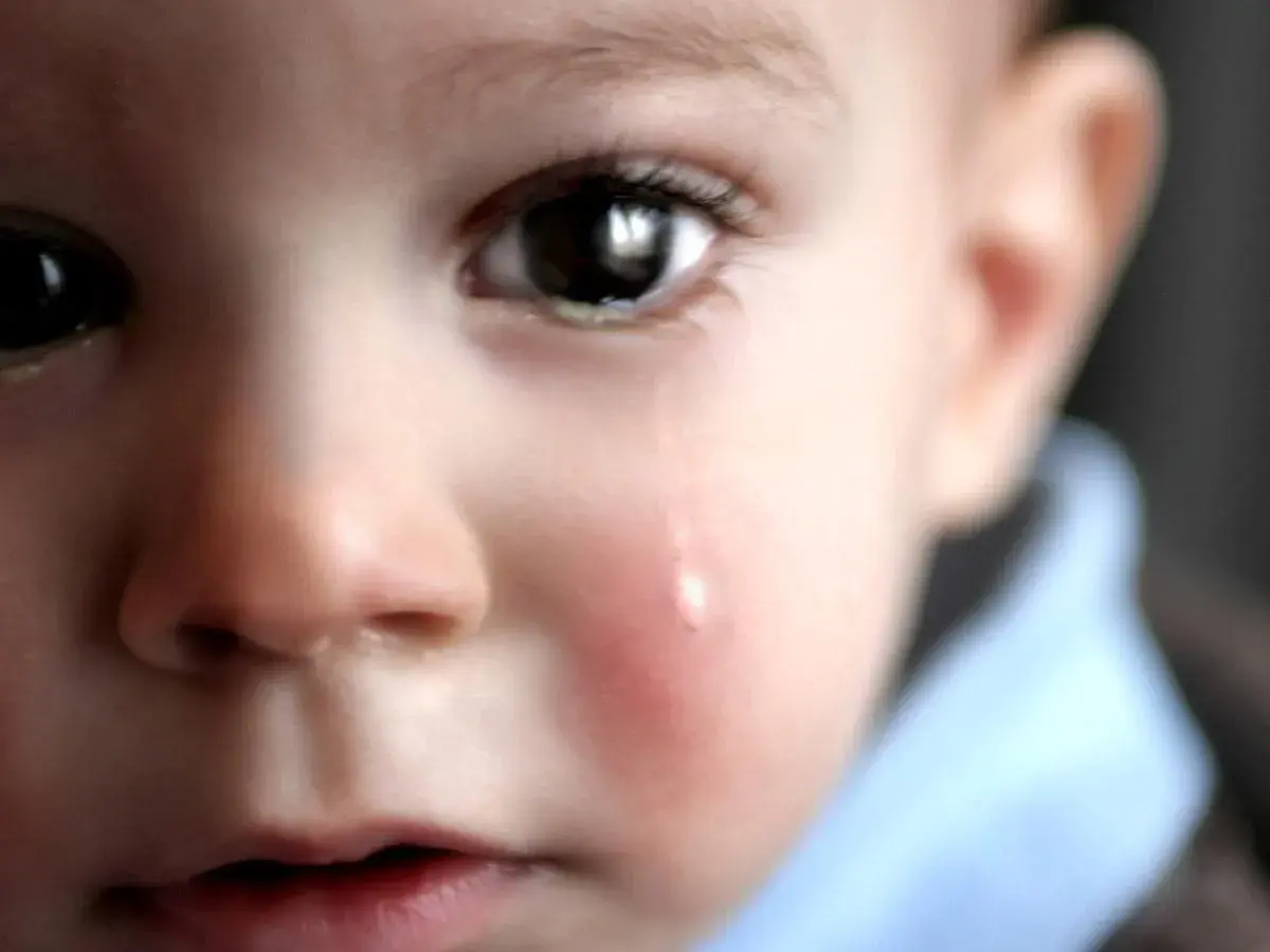 Un bambino piange, una lacrima scende sulla sua guancia arrossata. L'orzaiolo sui suoi occhietti lo fa soffrire.