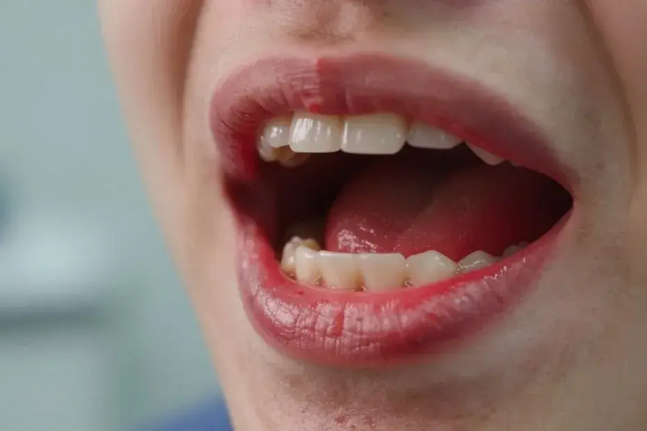 Podrażnione dziąsła? Sprawdzone sposoby i kiedy iść do dentysty