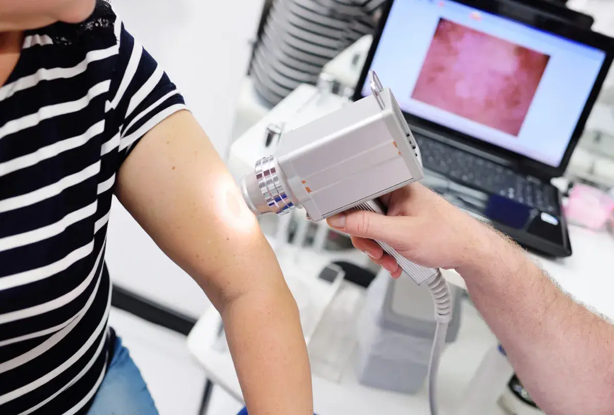 Dermatoskopia co to? Lekarz bada znamiona na ramieniu pacjentki za pomocą dermatoskopu, obraz widoczny na ekranie laptopa.