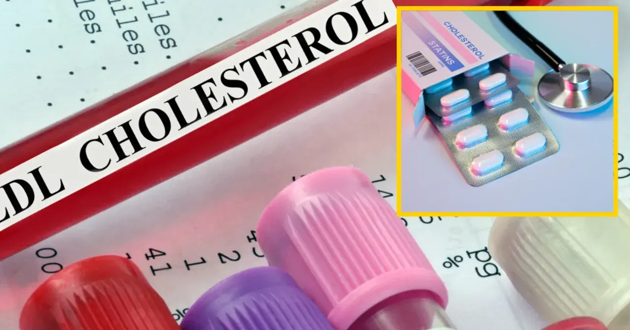 Czy leki na cholesterol odchudzają? Sprawdź, co mówią badania