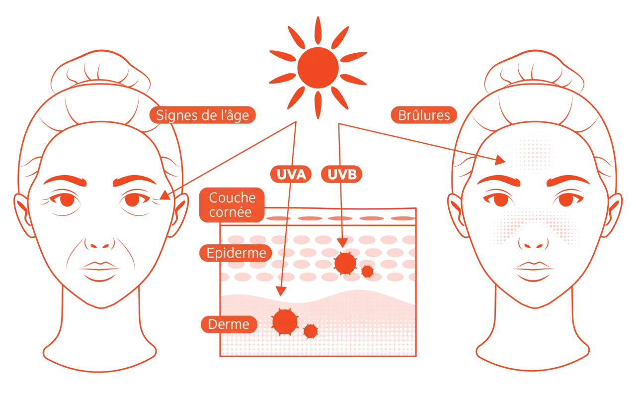 Illustration montrant les effets des rayons UVA et UVB sur la peau : vieillissement prématuré et coups de soleil.