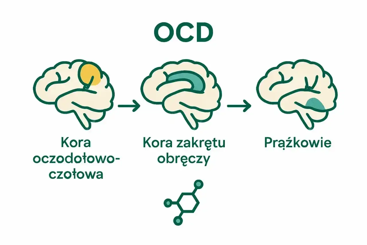 Schemat mózgu ilustrujący OCD. Pokazuje zmiany w korze oczodołowo-czołowej, korze zakrętu obręczy i jądrach podstawy, które mogą prowadzić do zachowań kompulsywnych.
