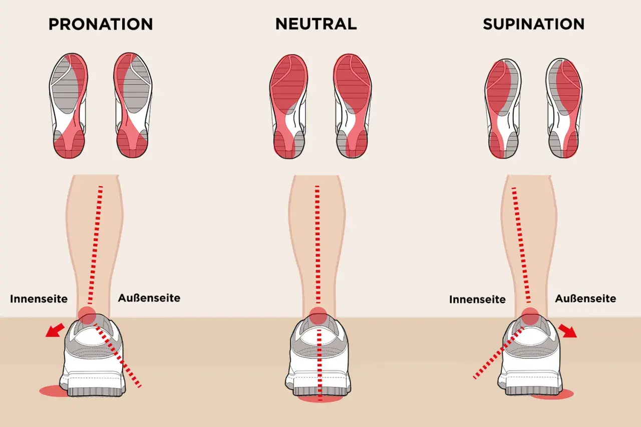 Illustration zeigt drei Laufstile: Pronation, Neutral und Supination. Bei Pronation knickt der Fuß nach innen ab.