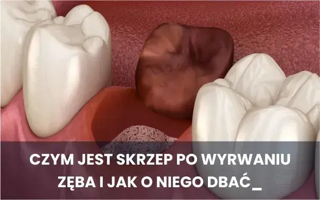 Skuteczne sposoby na płukanie spuchniętych dziąseł, które przynoszą ulgę