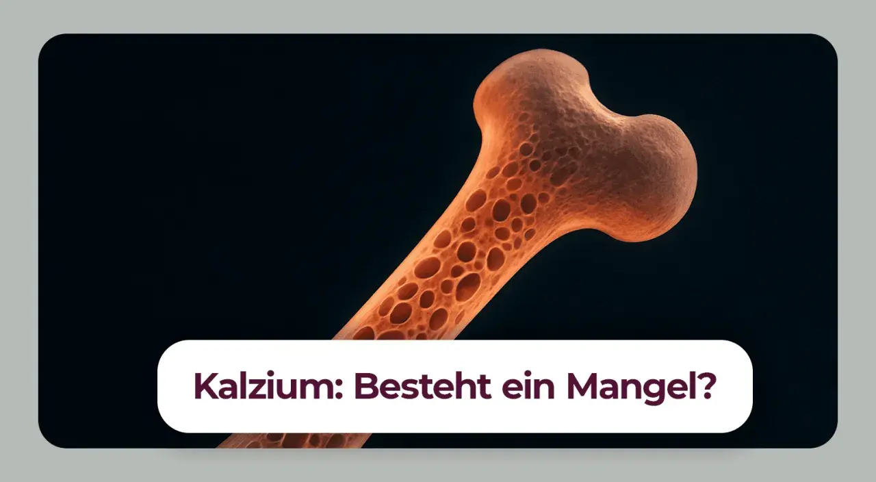 Vergrößerte Darstellung eines porösen Knochens, der auf einen Kalziummangel hindeutet. Ein Kalziummangel kann zu neurologischen Symptomen führen.
