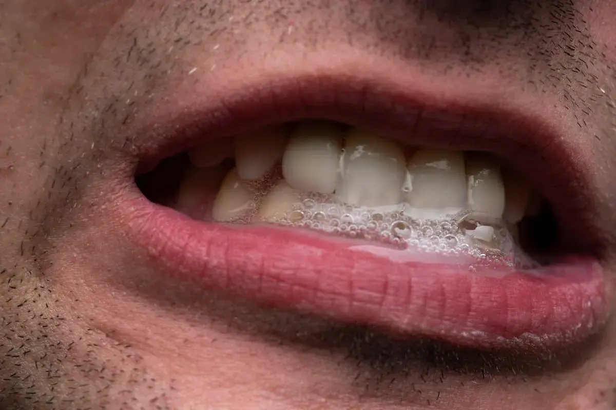 Bocca con schiuma e denti visibili. La salivazione eccessiva può essere un sintomo di ansia.