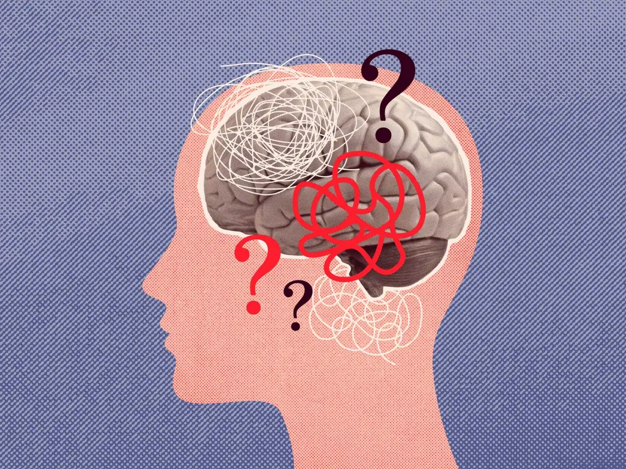 Profilo stilizzato con cervello e grovigli di pensieri, punti interrogativi che simboleggiano l'overthinking significato.