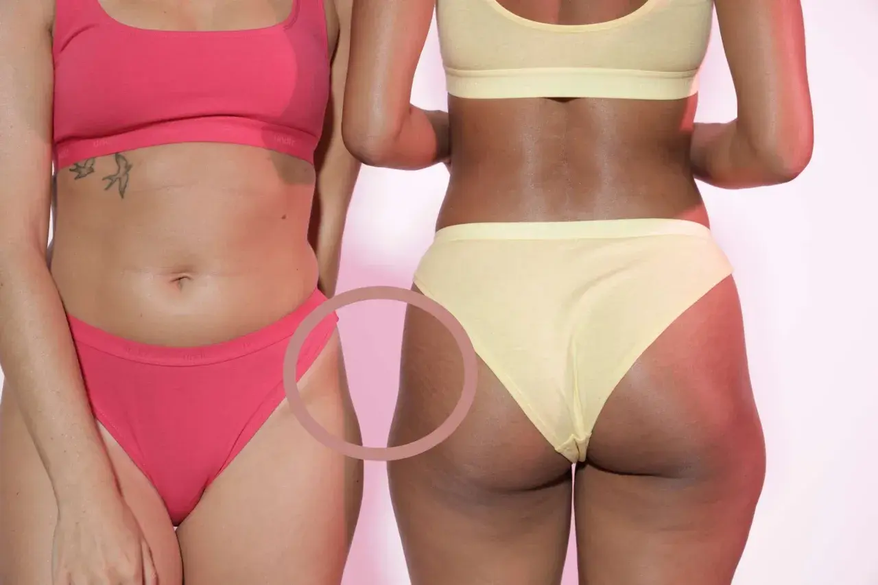 Deux femmes en sous-vêtements. La femme de droite, en jaune, montre des marques sur ses **hips dips**, une partie naturelle du corps.