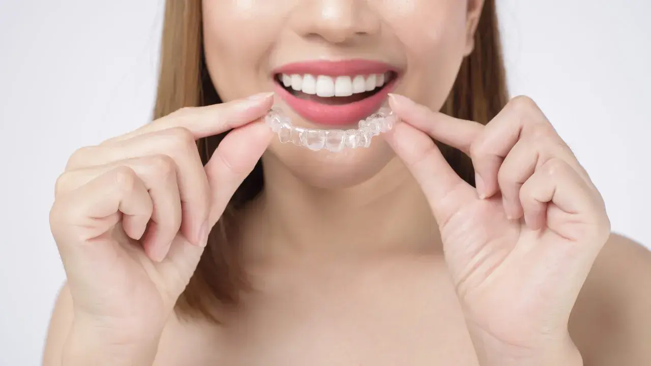 Sonrisa radiante con férula transparente de cera ortodoncia invisalign.