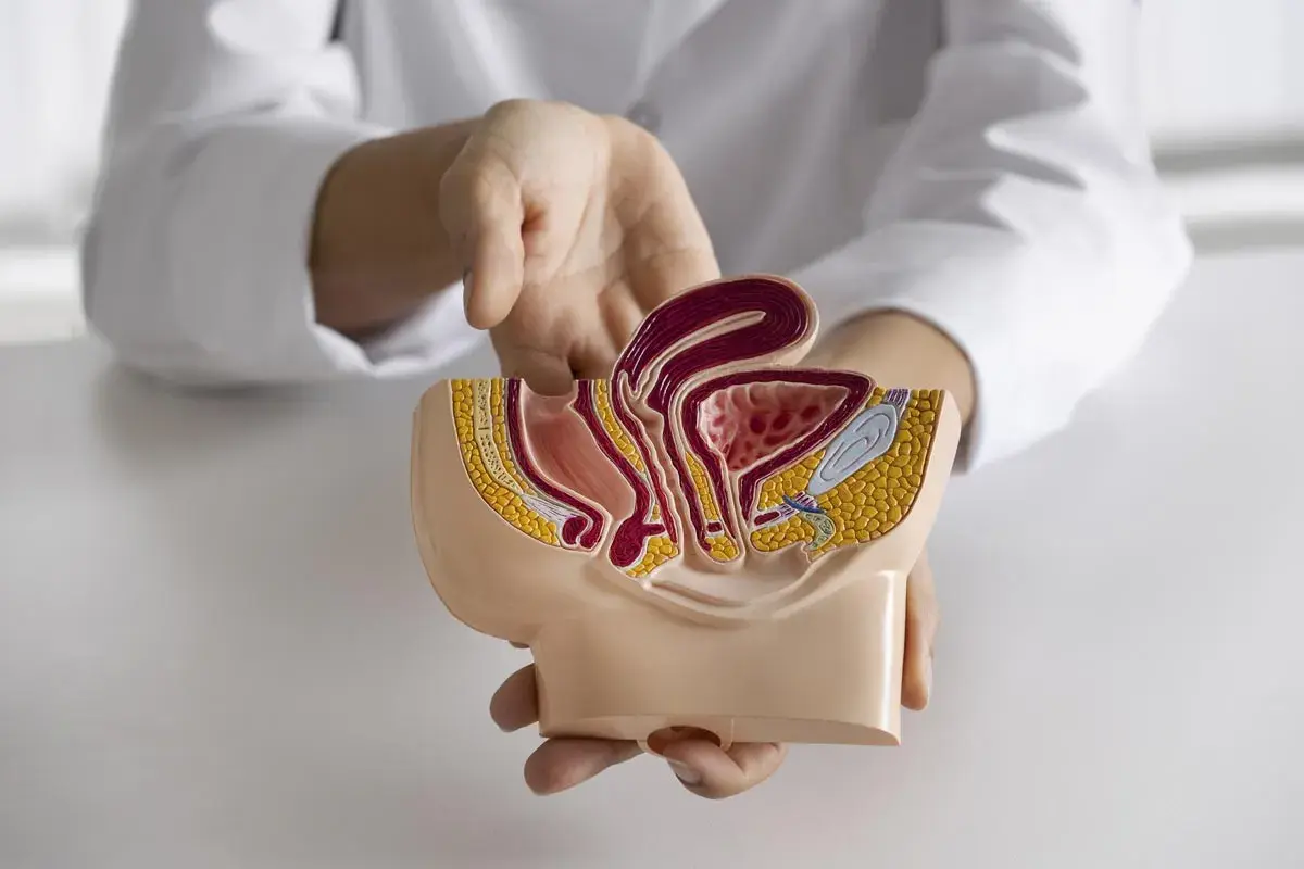 Modèle anatomique du pelvis féminin, montrant la vessie et l'utérus, utilisé pour expliquer une cystoscopie femme.