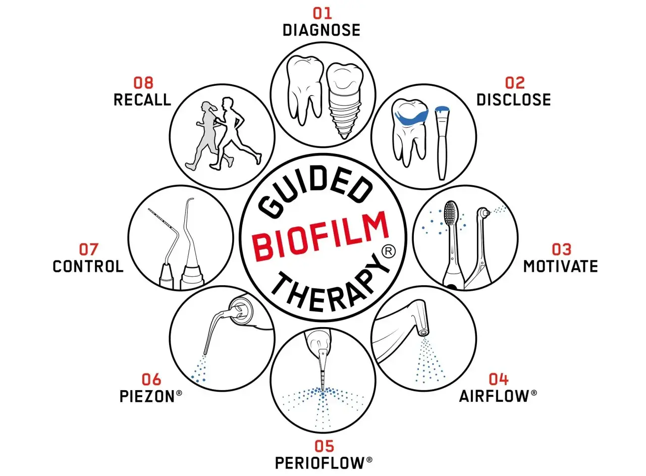 Schema della Guided Biofilm Therapy: diagnosi, rivelazione del biofilm batterico denti, motivazione, Airflow, Perioflow, Piezon, controllo e richiamo.