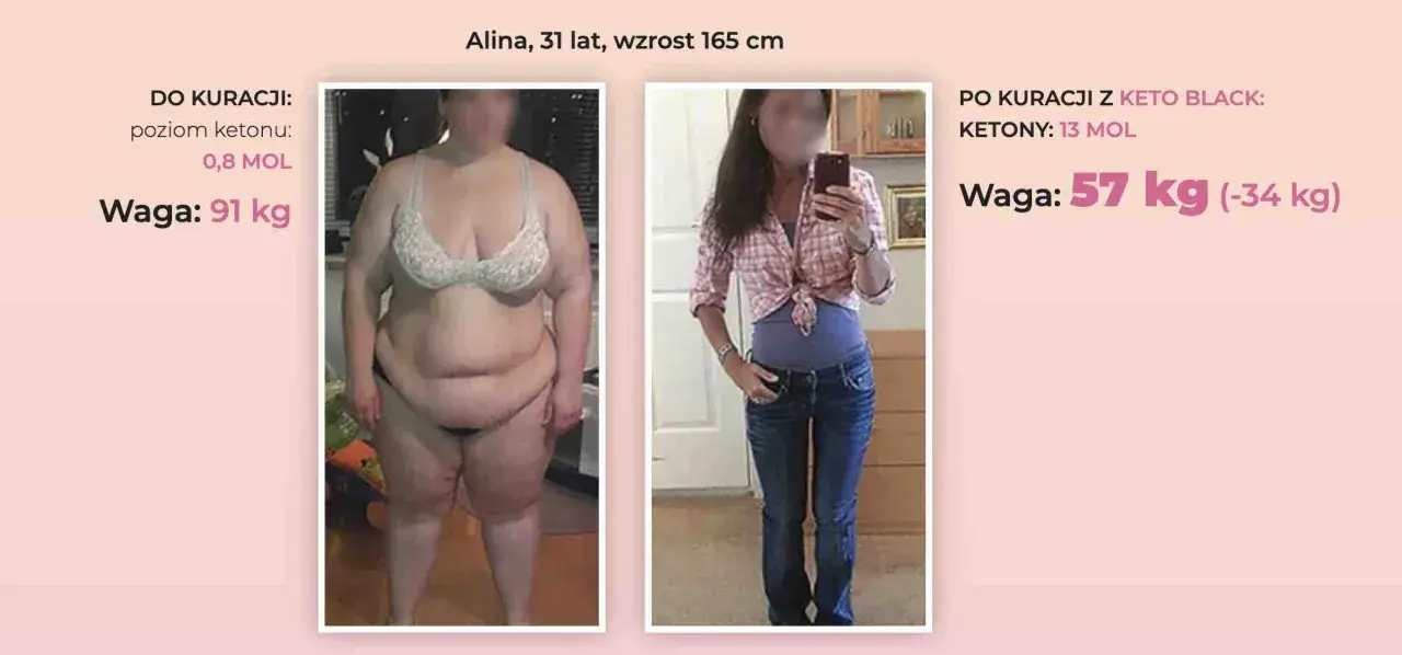 Przed i po kuracji Keto Black. Alina schudła 34 kg, co pokazuje, na czym polega dieta keto.