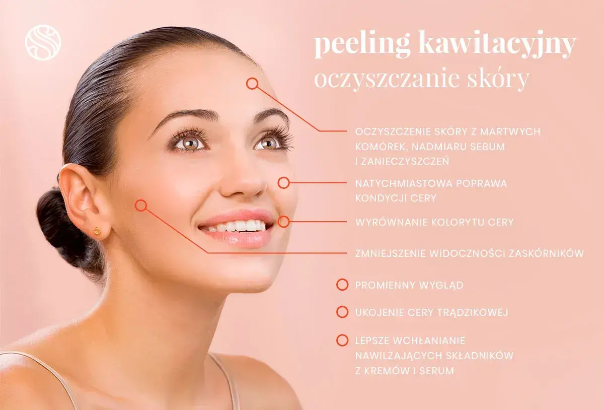 Kobieta z promienną cerą. Peeling kawitacyjny to głębokie oczyszczanie skóry, redukcja zaskórników i poprawa jej kondycji.