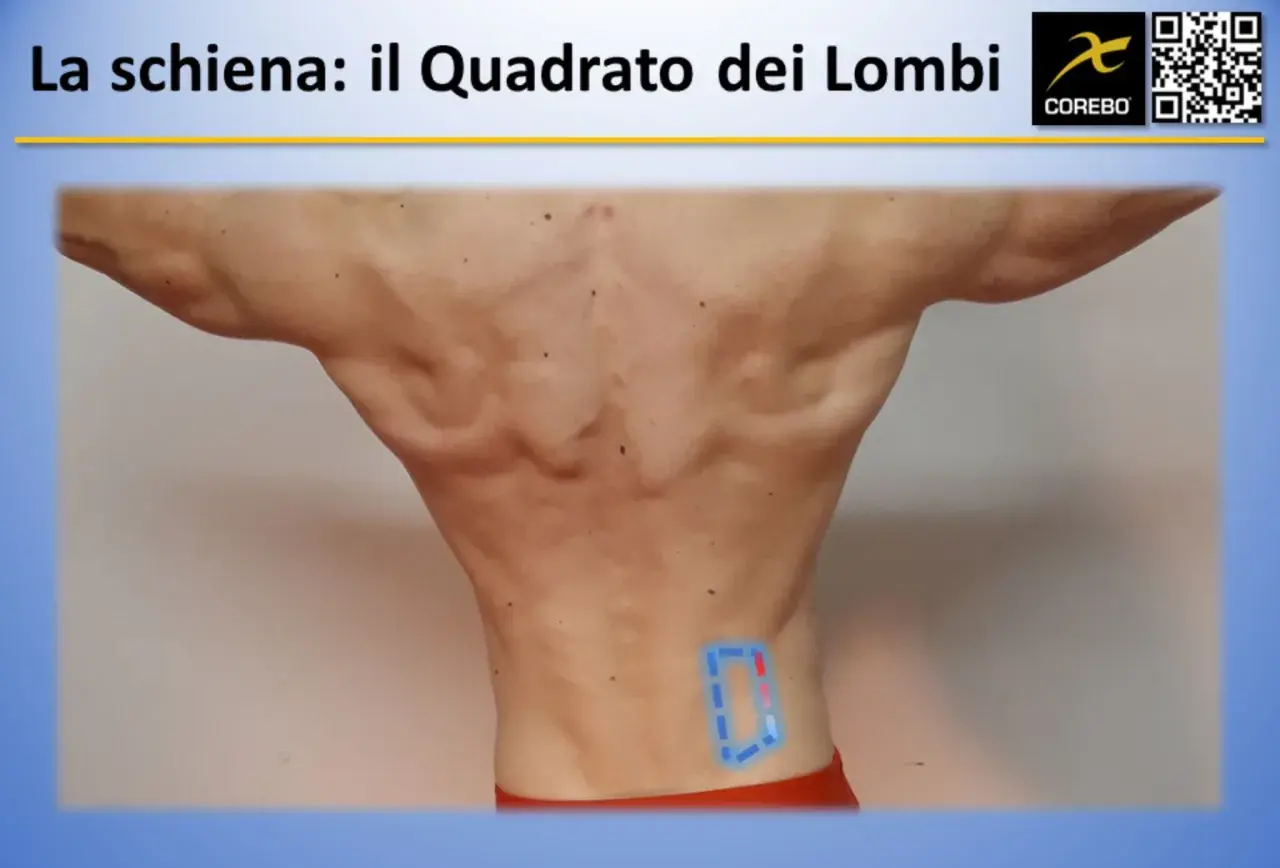 Vista posteriore di un uomo con evidenziate le fasce muscolari schiena, in particolare il quadrato dei lombi.