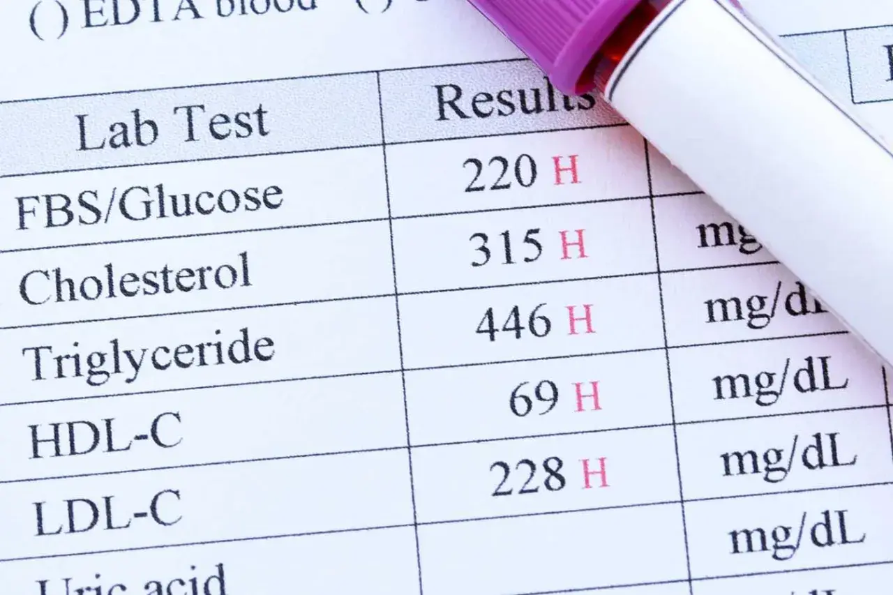 Résultats d'une prise de sang montrant des taux élevés de glucose, cholestérol et triglycérides. Une prise de sang sert à évaluer votre état de santé.