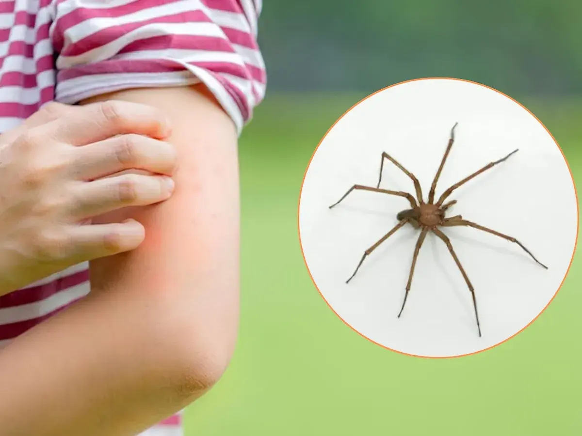 Brazo con erupción roja y picazón, junto a una araña marrón. Aprende cómo curar picadura de araña.