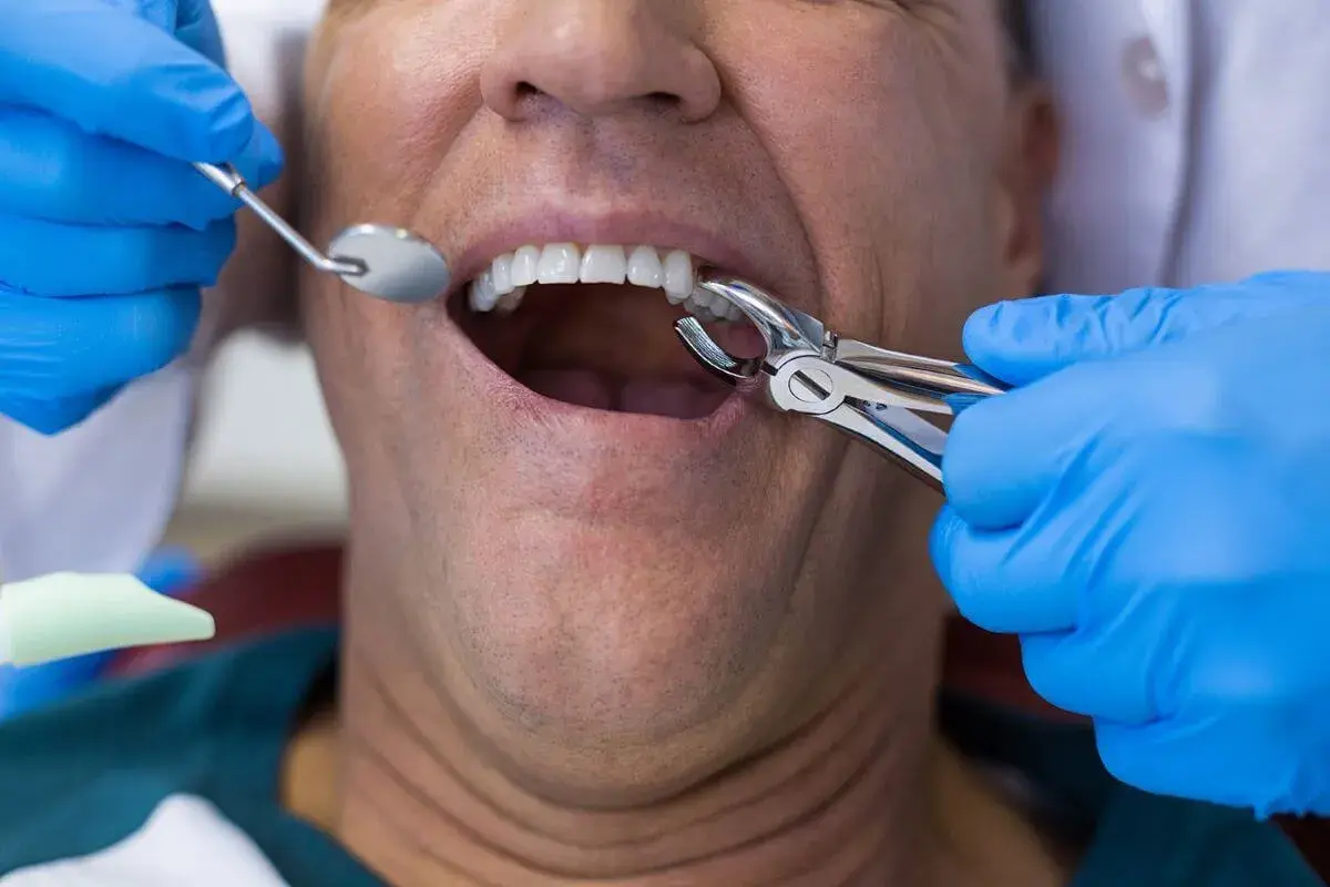 Dentista realiza extracción de muela infectada a paciente.