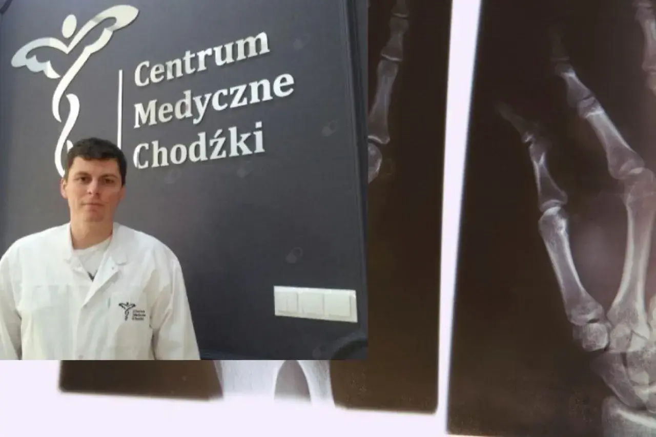 Lekarz w białym fartuchu na tle logo Centrum Medyczne Chodźki i zdjęcia rentgenowskiego dłoni.