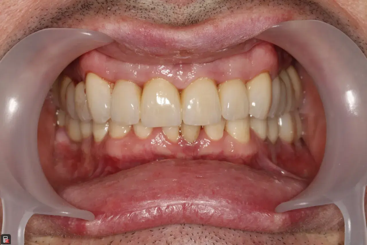 Zdrowe dziąsła i zęby to podstawa. Dowiedz się, czym jest periodontologia i jak dbać o piękny uśmiech.
