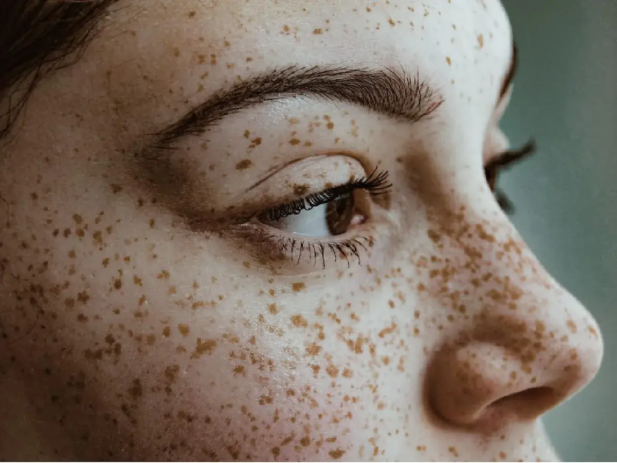 Zbliżenie na twarz z licznymi piegami, które przypominają naturalne piegi henna.