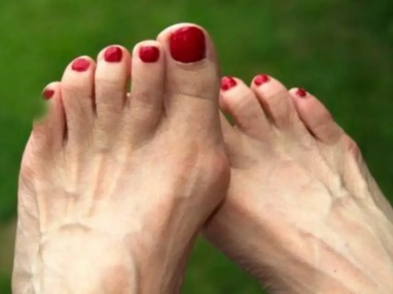 Pies con uñas rojas, mostrando un juanete. Buscando remedios caseros para el dolor de juanetes.
