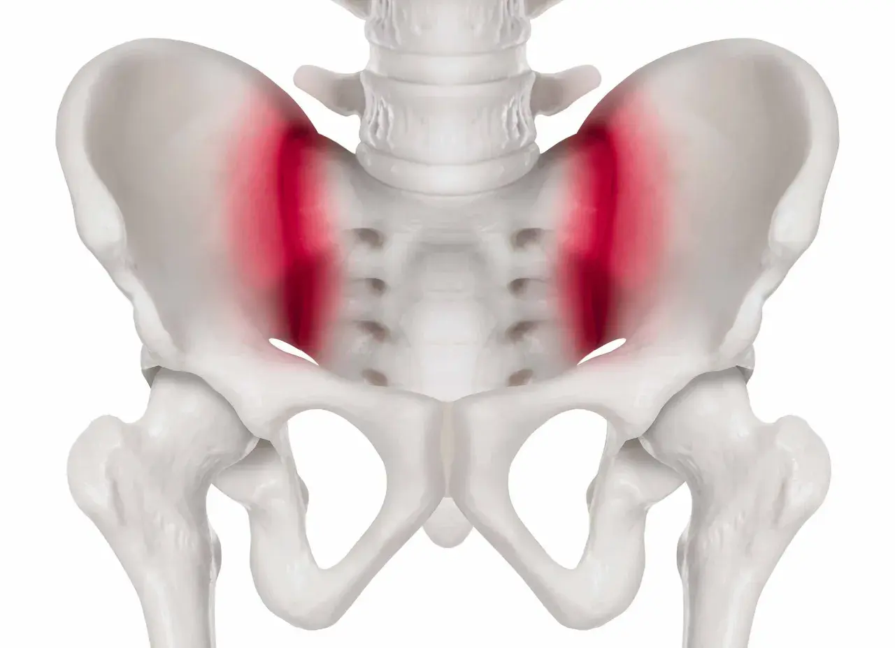 Skelettet visar bäckenet med markerad smärta i ligamenten, vanligt vid graviditet.