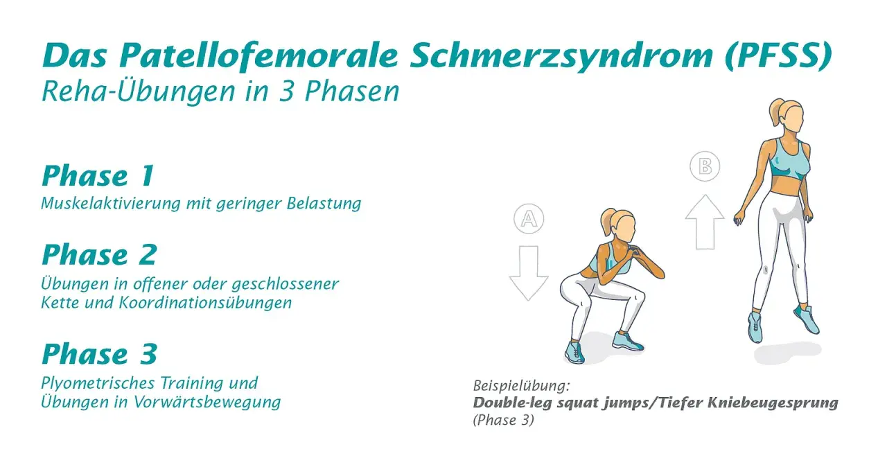 Reha-Übungen in 3 Phasen für das Patellofemorale Schmerzsyndrom (PFSS). Illustration zeigt eine Frau bei Kniebeugen und Sprüngen.
