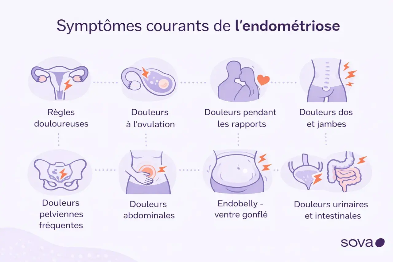 Symptômes courants de l'endométriose : règles douloureuses, douleurs à l'ovulation, douleurs pendant les rapports, douleurs dos et jambes, douleurs pelviennes, douleurs abdominales, endobelly, douleurs urinaires et intestinales.