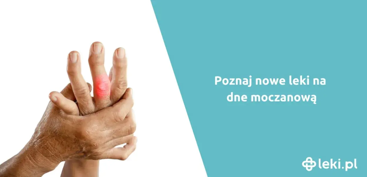 Jakie leki przeciwbólowe na dne moczanową mogą przynieść ulgę?