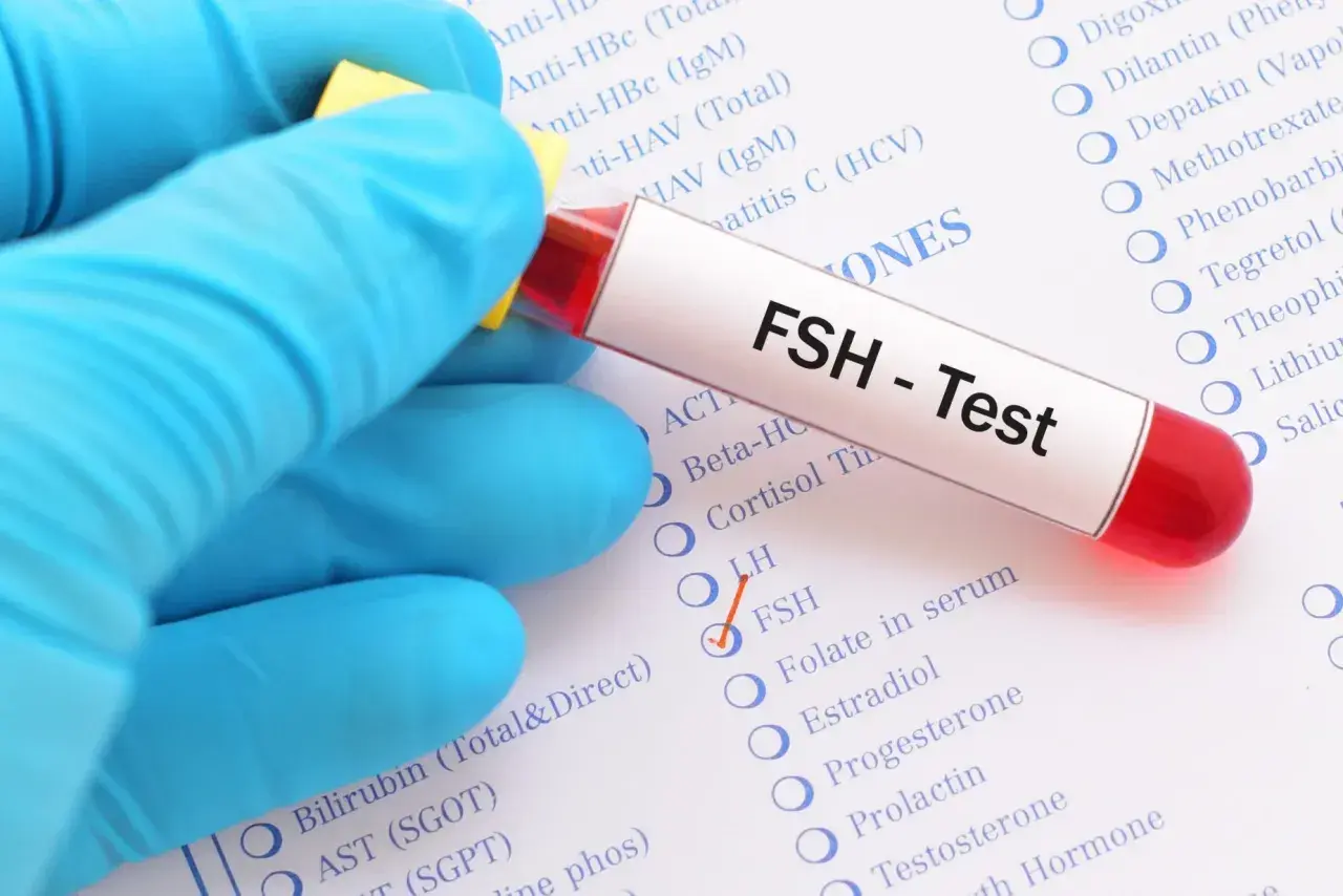 Ręka w niebieskiej rękawiczce trzyma probówkę z napisem "FSH - Test". Obok zaznaczono opcję FSH na liście badań.