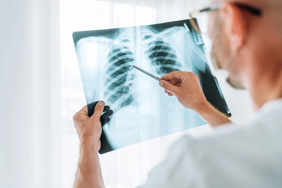 Medico esamina radiografia polmonare, evidenziando un caso di polmonite nosocomiale e valutando il potenziale risarcimento.