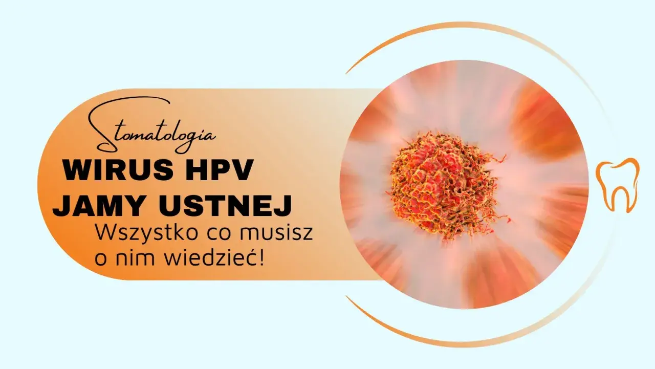 Wirus HPV w jamach ustnych może prowadzić do powstania brodawczaka. Dowiedz się więcej o tym zagrożeniu dla zdrowia jamy ustnej.