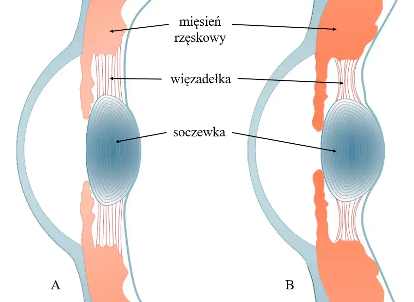 Jak działa soczewka oka i dlaczego ma kluczowe znaczenie dla wzroku