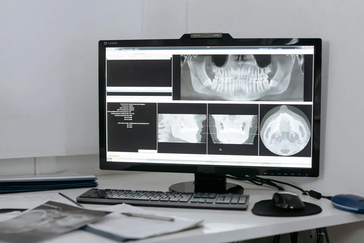 Teleradiologia – jakie korzyści daje placówkom medycznym?