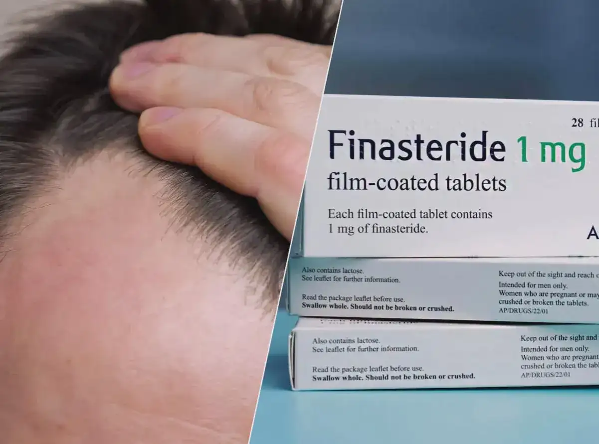 Mężczyzna dotyka przerzedzonych włosów obok pudełka leku Finasteride 1 mg, który może pomóc w walce z łysieniem.