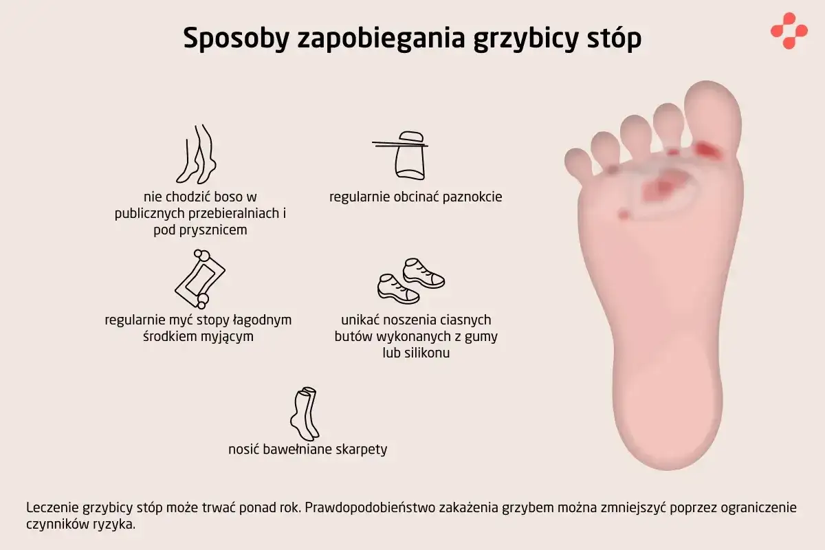 Ilustracja pokazuje sposoby zapobiegania grzybicy stóp: nie chodzić boso, myć stopy, obcinać paznokcie, unikać ciasnych butów, nosić bawełniane skarpety.