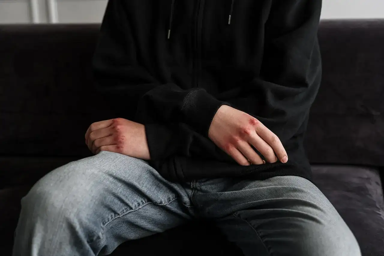Dłonie z otarciami, siedząca osoba w bluzie i jeansach. To mogą być niebieska karta konsekwencje.