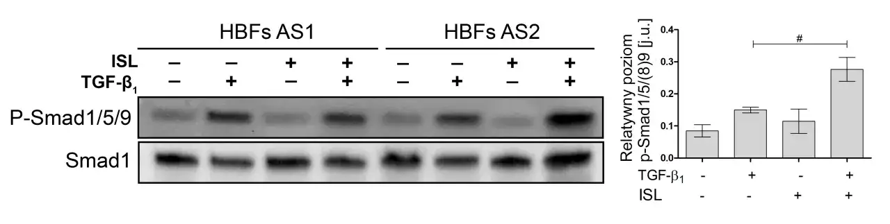 Western blot pokazujący poziom fosforylacji Smad1/5/9 w komórkach HBFs AS1 i AS2 po traktowaniu TGF-β₁ i ISL.