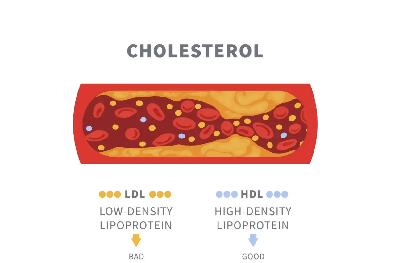 Schemat przedstawia przekrój naczynia krwionośnego z cholesterolem. Widać LDL (zły) i HDL (dobry), kluczowe dla lipidogramu normy.