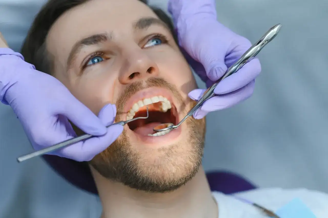 Dentysta usuwa kamień na zębach pacjenta za pomocą narzędzi stomatologicznych.