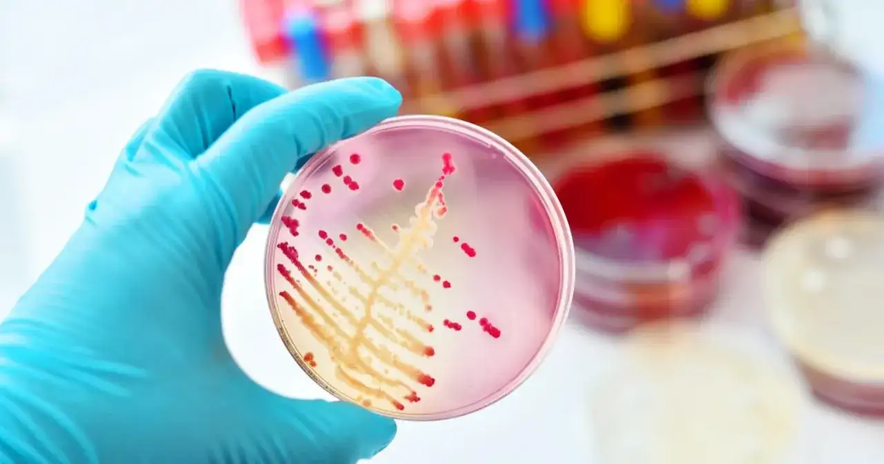 Rękawiczka w niebieskiej rękawiczce trzyma szalkę Petriego z czerwonymi koloniami bakterii, być może Klebsiella pneumoniae, na różowym podłożu.