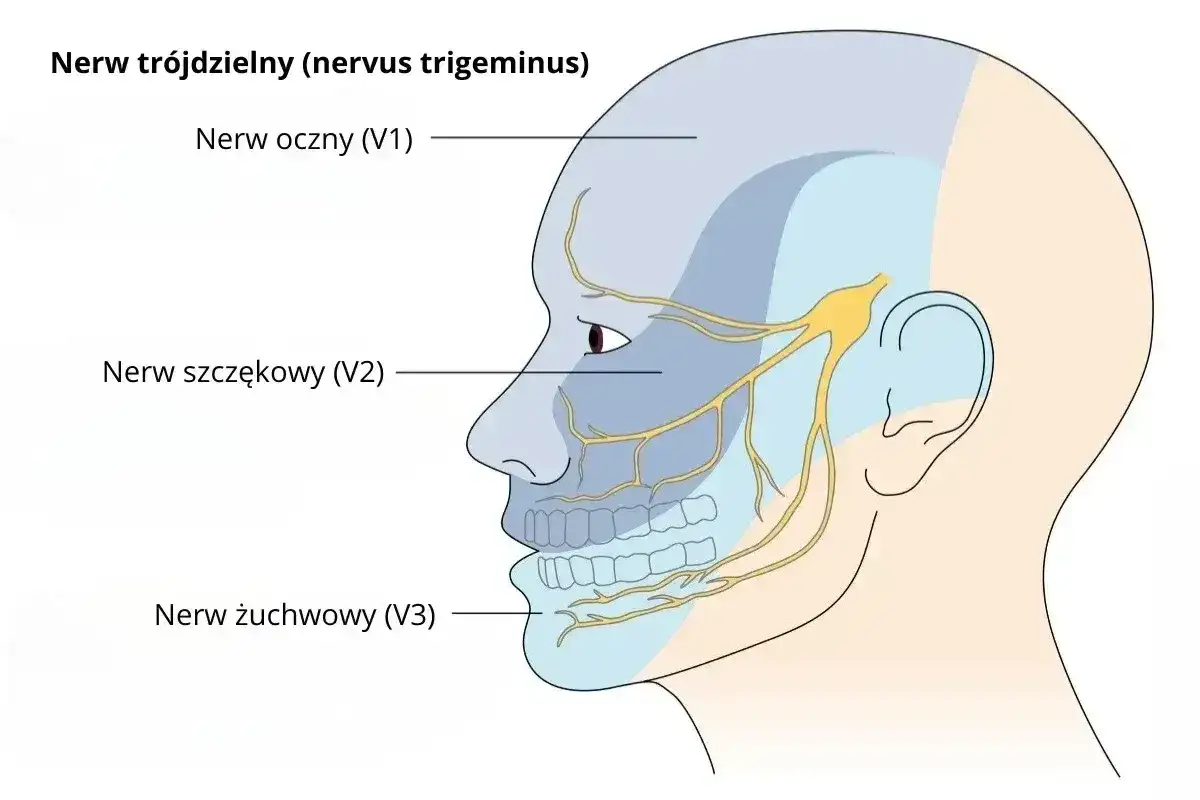 Schematyczny rysunek głowy z zaznaczonymi obszarami unerwienia nerwu trójdzielnego: nerw oczny (V1), szczękowy (V2) i żuchwowy (V3).
