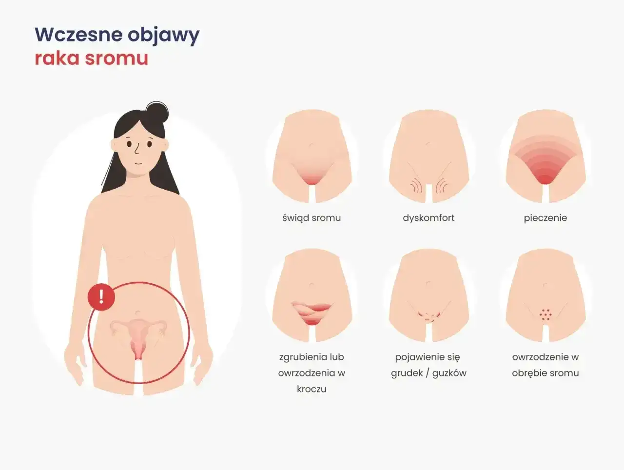 Wczesne objawy raka sromu: świąd, pieczenie, dyskomfort, zgrubienia, grudki, owrzodzenia. Zwróć uwagę na te sygnały.