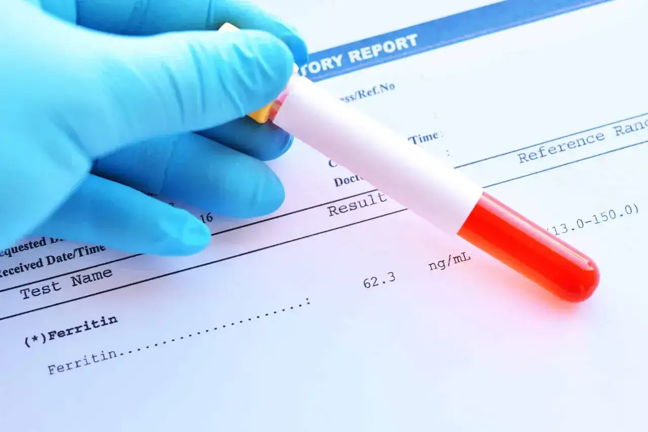 Ręka w niebieskiej rękawiczce trzyma probówkę z krwią nad raportem laboratoryjnym. Wynik ferrytyny 62.3 ng/mL mieści się w normie.