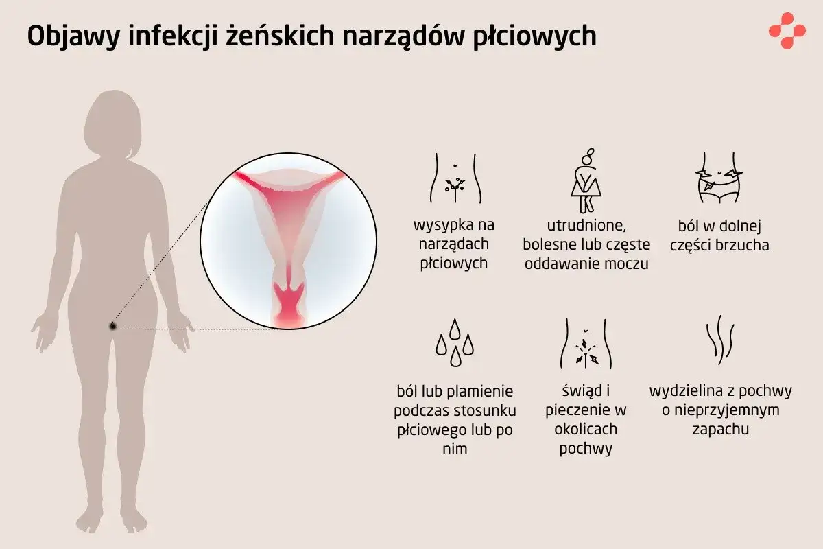 Objawy infekcji narządów płciowych: wysypka, ból brzucha, problemy z oddawaniem moczu, ból podczas stosunku, świąd, pieczenie i nieprzyjemna wydzielina. To mogą być symptomy choroby wenerycznej.